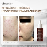 Serum kiềm dầu trị mụn Ekseption Hyaluronic ZnPCA 75ml