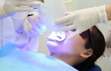 Lấy cao răng định kỳ , tẩy trắng răng laser