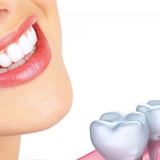 Làm cầu răng sứ cố định