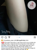 Kem trị rạn da StectHeal cho mẹ bầu