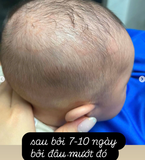 KEM DƯỠNG MLE ATOPALM 100ML
