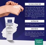KEM DƯỠNG MATIDERM 30ML