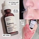 THE ORDINARY AHA 30%+BHA 2% PEELING SOLUTION