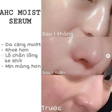 SERUM AHC CAPTURE SOLUTION SIGNATURE 50ML