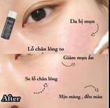 TẨY DA CHẾT PAULA CHOICE  2% BHA LIQUID EXFOLIANT 30ML
