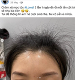 TINH CHẤT L'OREAL AMINEXIL ADVANCED GIẢM RỤNG & LÀM DÀY TÓC 30ML FULLBOX