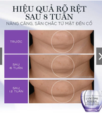KEM DƯỠNG LANCOME RENERGIE TÍM 15ML UNBOX