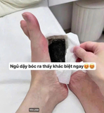 HỘP 56 MIẾNG DÁN CHÂN NGẢI CỨU ĐÔNG NHÂN ĐƯỜNG