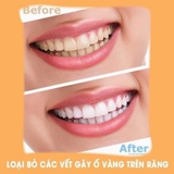 MIẾNG DÁN TRẮNG RĂNG SMILE COSMETIQUE 1 HỘP 6 MIẾNG