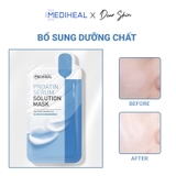 Mediheal Solution Mask 3 loại (Black - Serum - Teca)