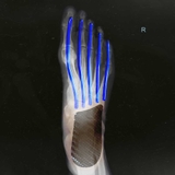 Adizero Adios Pro 'Trắng San Hô'