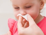 Trẻ bị nghẹt mũi về đêm: 5 nguyên nhân phổ biến mẹ cần biết