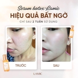 Serum Idebenone LAMIC (35ml) – Phục hồi & hỗ trợ làm chậm lão hoá da - Minie - Chọn đúng. Đẹp bền.