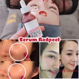Serum So'Natural Làm Giảm Mụn, Tái Tạo Làn Da 35ml Red Peel Tingle Serum