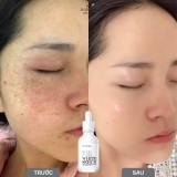 Red Peel White Serum Tinh Chất Tái Tạo Da