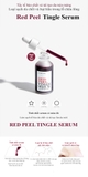 Serum So'Natural Làm Giảm Mụn, Tái Tạo Làn Da 35ml Red Peel Tingle Serum