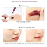 Serum So'Natural Làm Giảm Mụn, Tái Tạo Làn Da 35ml Red Peel Tingle Serum