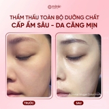 Mặt nạ dưỡng ẩm d'Alba White Truffle Nourishin Treatment Mask