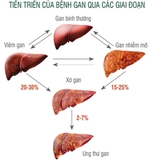 VIÊN UỐNG BỔ GAN KWANGDONG Hộp 120 viên