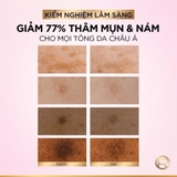 Serum L'Oreal Glycolic Bright Melasyl 8% Sáng Da, Mờ Thâm Mụn & Nám 30ml (Mới)