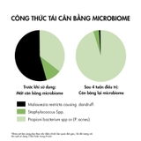 Dầu Gội Vichy Sạch Gàu Cho Da Đầu Dầu, Ngứa