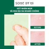 Miếng Dán Mụn Some By Mi Clear Spot Patch 18 Miếng