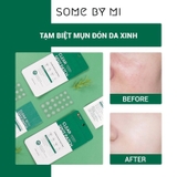 Miếng Dán Mụn Some By Mi Clear Spot Patch 18 Miếng
