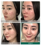 Nước Hoa Hồng Some By Mi AHA-BHA-PHA Cho Da Mụn 150ml