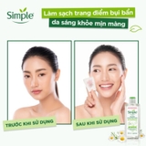 Nước Tẩy Trang Simple Micellar Cleansing Water Làm Sạch và Cấp Ẩm Cho Da