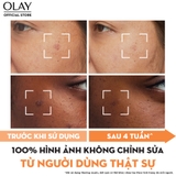 Kem Dưỡng Olay Luminous Niacinamide & Vitamin C Giúp Mờ Vết Thâm, Đốm Nâu, Dưỡng Sáng Da 50g