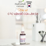 Serum So'Natural Red Peel Tingle Serum Làm Giảm Mụn, Tái Tạo Làn Da 35ml