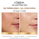 Toner L'Oreal Glycolic Bright Peeling Toner Tái Tạo Da, Dưỡng Sáng Và Căng Mịn 128ml