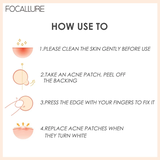 Miếng Dán Mụn Focallure Acne Pimple Patch 24 Miếng