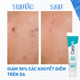 Gel Giảm Mụn Không Khô Da CeraVe Blemish Control Gel 40ml