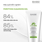 Sữa Rửa Mặt Làm Sạch Dịu Nhẹ Cho Da Dầu Mụn BABE Stop AKN Purifying Cleansing Gel