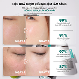 Serum Dưỡng Trắng Mờ Thâm 460x Vitamin C Sinh Học Kakadu 22% Neogen Dermalogy 32g