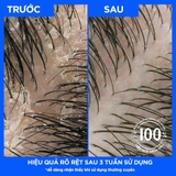 Dầu Gội Và Xả 2in1 Sạch Gàu Head&Shoulders Mỹ Sạch Sâu 613ml