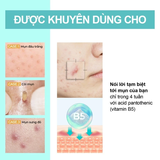 Kem Dưỡng Làm Dịu Da Numbuzin No.1 Pantothenic B5 Active Soothing Cream 80ml