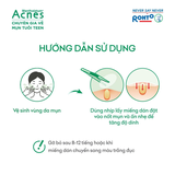 Miếng Dán Mụn Acnes Giúp Giảm Mụn Sưng Viêm 24 Miếng