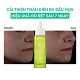 Serum Bioderma Sébium Serum Sáng Mịn, Mờ Thâm Cho Da Dầu Mụn 30ml