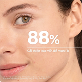 Serum Bioderma Sébium Serum Sáng Mịn, Mờ Thâm Cho Da Dầu Mụn 30ml