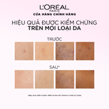 Tinh Chất Tẩy Tế Bào Chết L'Oreal Paris Glycolic Bright Anti Dark Spot Exfoliant Peel 25ml