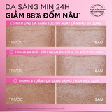 Kem Dưỡng L’Oréal Paris Làm Mờ Thâm Nám Glycolic-Bright Matte Luminizing Cream 50ml