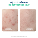 Kem Dưỡng Bioderma Sébium Sensitive Cho Da Mụn Nhạy Cảm