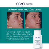 Dung Dịch Tẩy Tế Bào Chết, Ngừa Mụn Obagi BHA 2% Clenziderm M.D. Exfoliating 148ml