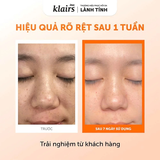 Nước Hoa Hồng Dear Klairs Freshly Juiced Vitamin Essence Toner Hỗ Trợ Sáng Da 180ml