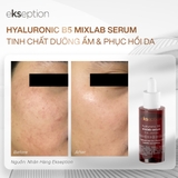 Serum Ekseption Hyaluronic B5, HA + 5% B5 Dưỡng Ẩm Phục Hồi Da 75ml