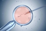 Kỹ Thuật ICSI Là Gì? Quy Trình, Chi Phí Và Sự Khác Biệt Với IVF