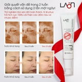 Kem nám LoanMedi Melasma Care Cream