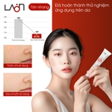 Kem nám LoanMedi Melasma Care Cream